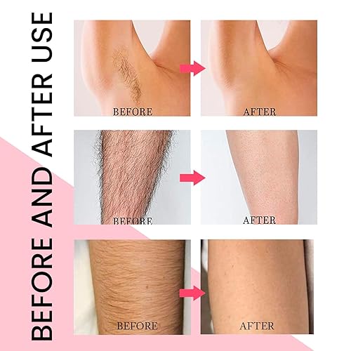 MEOLY Hair Removal Cream for Women: Sensitive Formula for Intimate Area - 4.01oz / 120g…