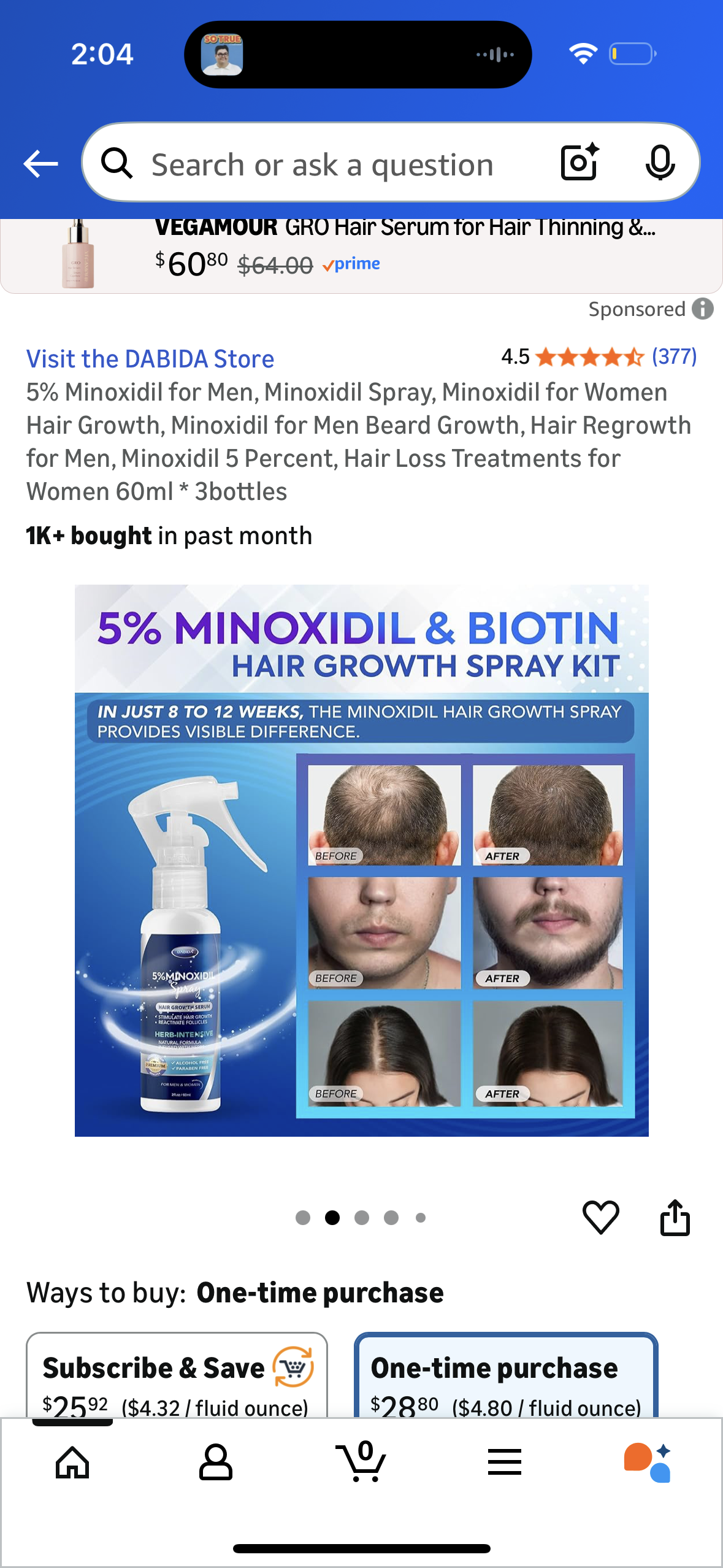 5% Minoxidil for Men, Minoxidil Spray, Minoxidil for Women Hair Growth, Minoxidil for Men Beard Growth, Hair Regrowth for Men, Minoxidil 5 Percent, Hair Loss Treatments for Women 60ml * 3bottles