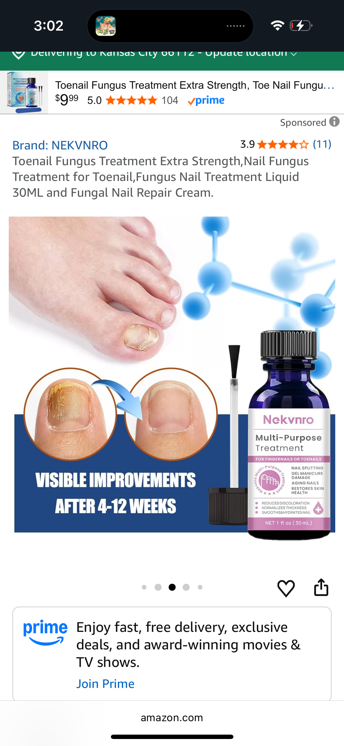 Toenail Fungus Treatment Extra Strength,Nail Fungus Treatment for Toenail,Fungus Nail Treatment Liquid 30ML and Fungal Nail Repair Cream